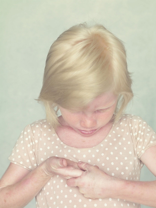 Остался с альбиносом