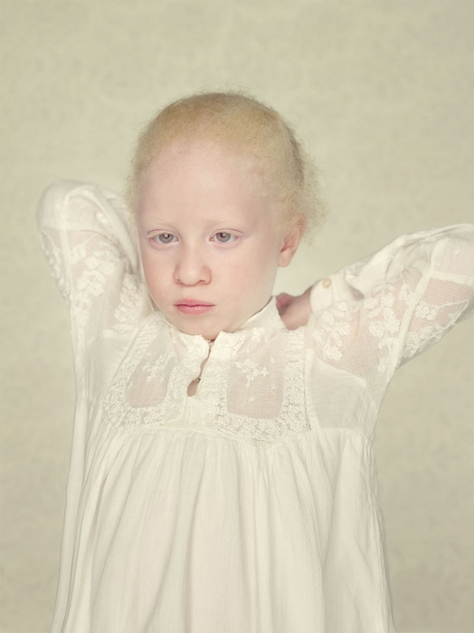 Остался с альбиносом