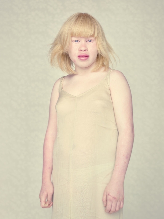 Остался с альбиносом