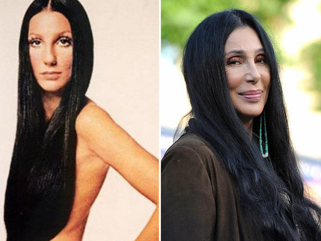 Знаменитости, которым пластические операции пошли на пользу Знаменитости, которым пластические операции пошли на пользу