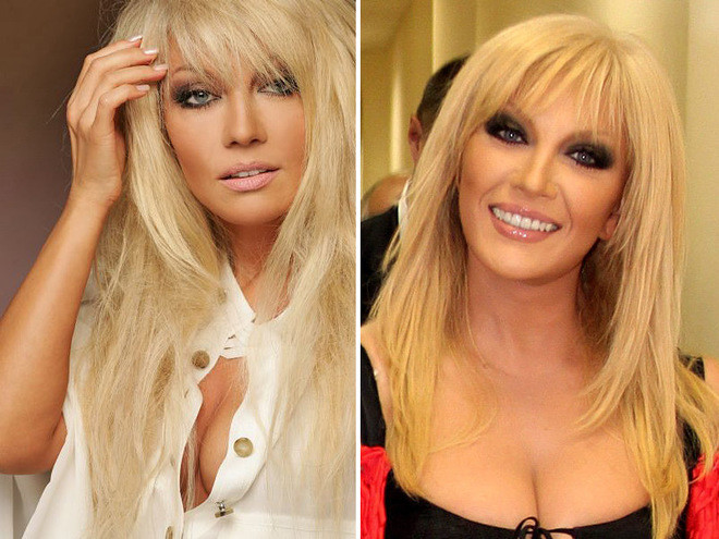 Знаменитости, которым пластические операции пошли на пользу Знаменитости, которым пластические операции пошли на пользу