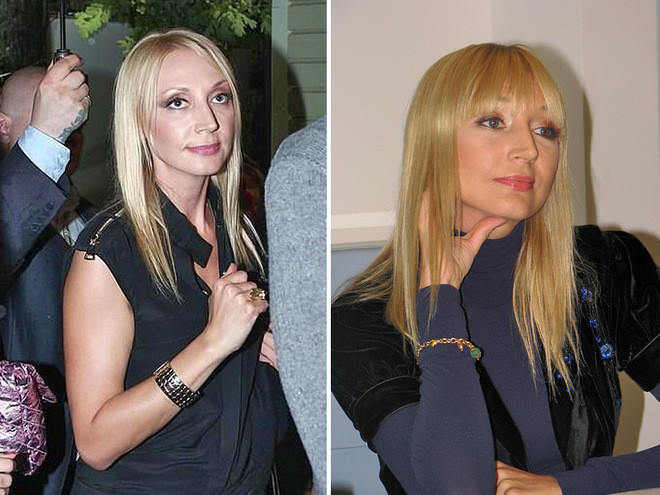 Знаменитости, которым пластические операции пошли на пользу Знаменитости, которым пластические операции пошли на пользу