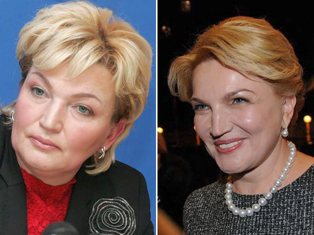 Знаменитости, которым пластические операции пошли на пользу Знаменитости, которым пластические операции пошли на пользу