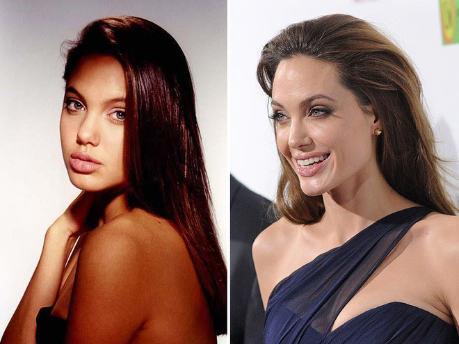 Знаменитости, которым пластические операции пошли на пользу Знаменитости, которым пластические операции пошли на пользу