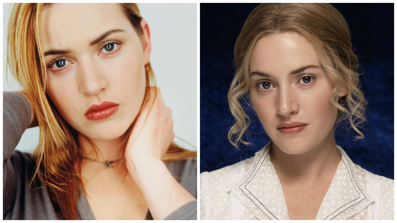 Знаменитости, которым пластические операции пошли на пользу Знаменитости, которым пластические операции пошли на пользу