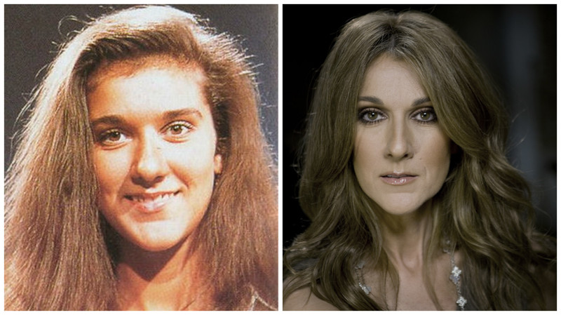 Знаменитости, которым пластические операции пошли на пользу Знаменитости, которым пластические операции пошли на пользу