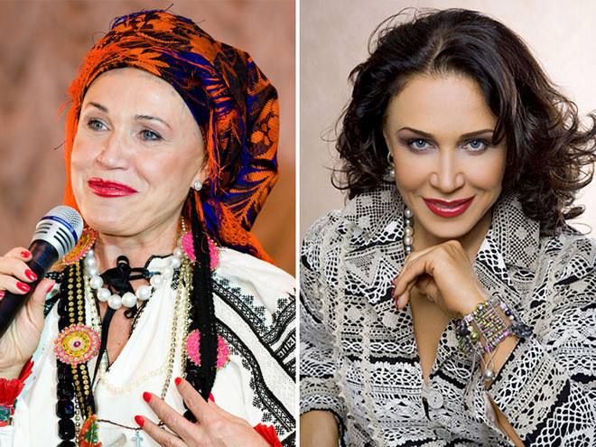 Знаменитости, которым пластические операции пошли на пользу Знаменитости, которым пластические операции пошли на пользу