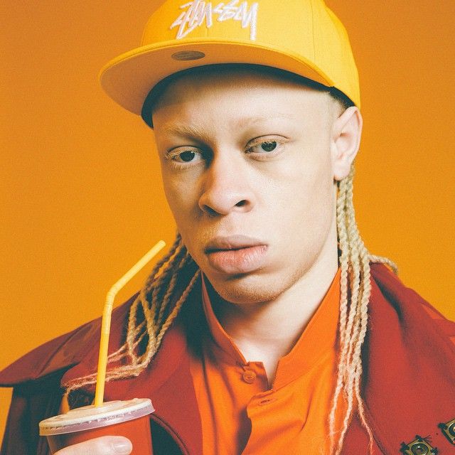 Альбинос, родившийся у чернокожих родителей, стал моделью и поддерживает таких же детишек