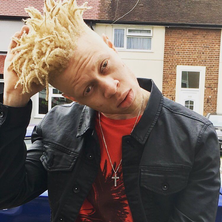 Альбинос, родившийся у чернокожих родителей, стал моделью и поддерживает таких же детишек