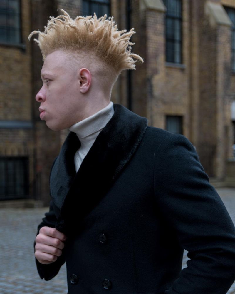 Альбинос, родившийся у чернокожих родителей, стал моделью и поддерживает таких же детишек