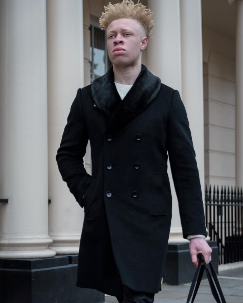 Альбинос, родившийся у чернокожих родителей, стал моделью и поддерживает таких же детишек