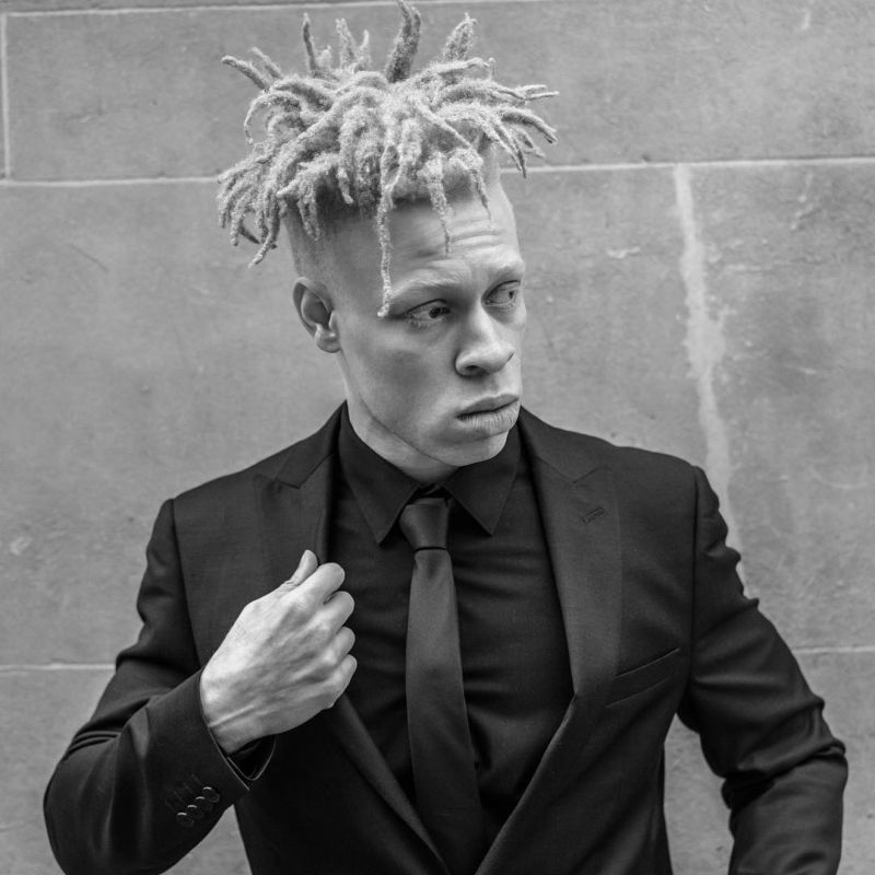 Альбинос, родившийся у чернокожих родителей, стал моделью и поддерживает таких же детишек