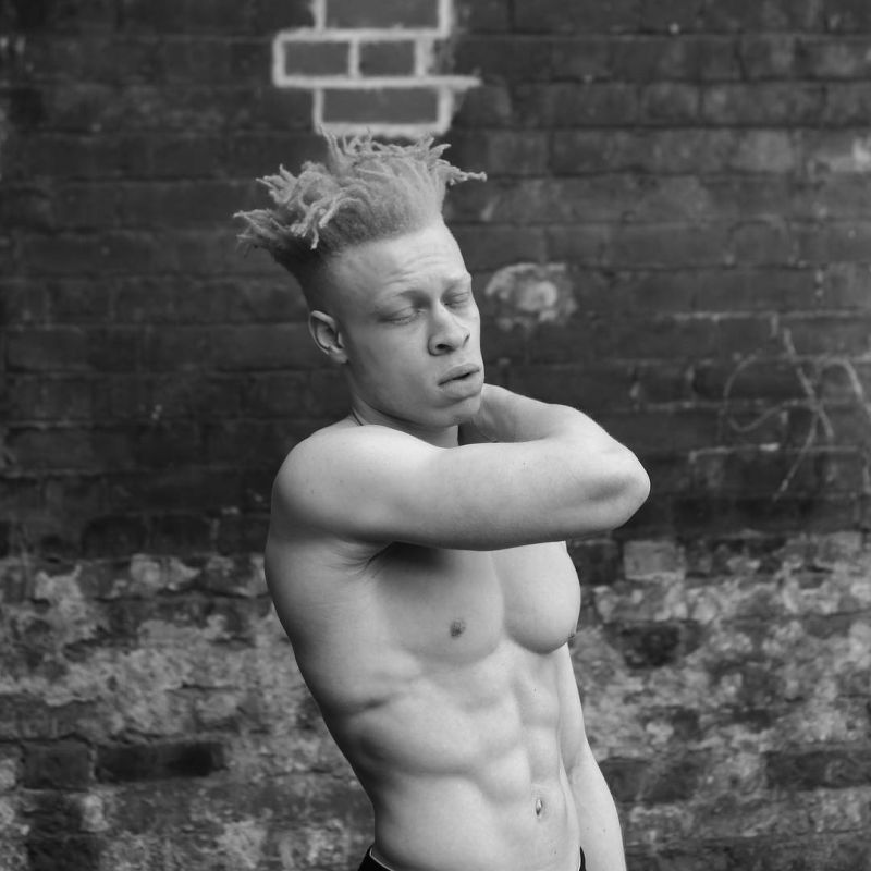 Альбинос, родившийся у чернокожих родителей, стал моделью и поддерживает таких же детишек