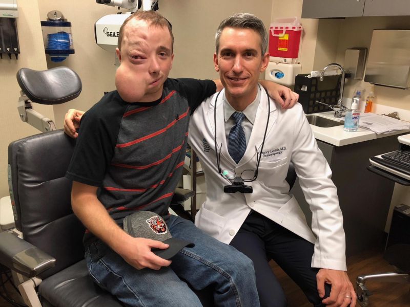 Парню с огромной опухолью на лице до и после операции