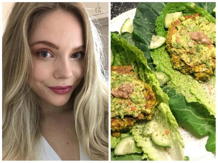 До и после акне: 5 реальных историй девушек, которые смогли победить прыщи