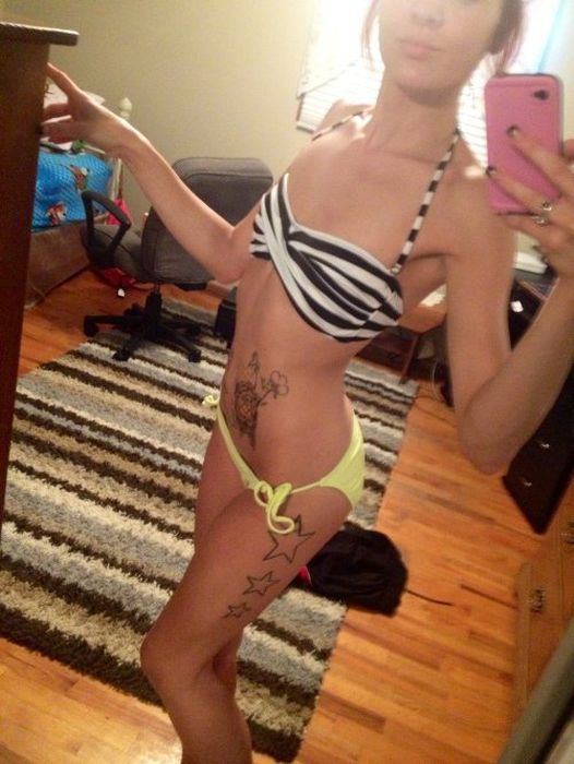 Самострелы