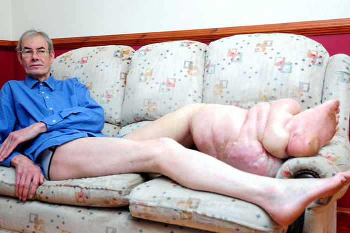 10 самых страшных паразитов, которые могут жить в человеческом теле