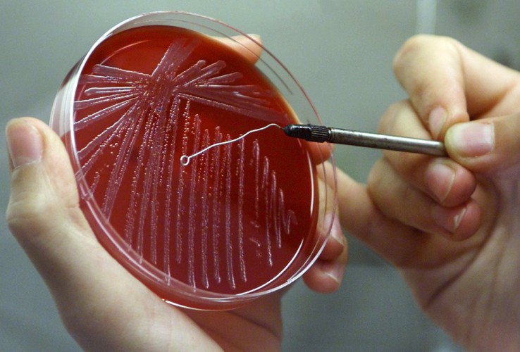 История эпидемии Сибирской язвы в СССР