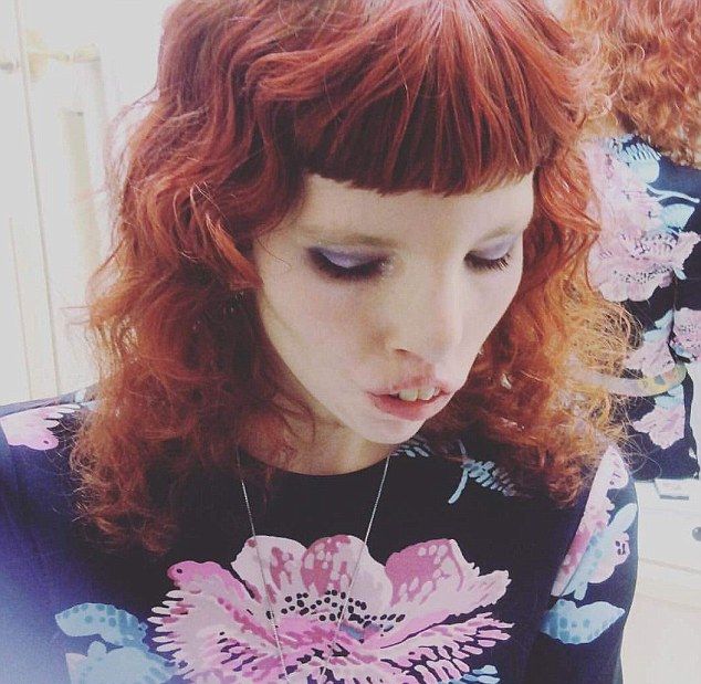 Жутковатая фотосессия модели с кошачьим синдромом