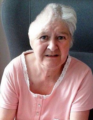 Женщина осталась без половины головы после того, как попала под автобус