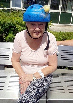 Женщина осталась без половины головы после того, как попала под автобус