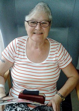 Женщина осталась без половины головы после того, как попала под автобус