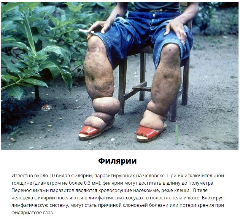 10 паразитов, которых следует опасаться летом