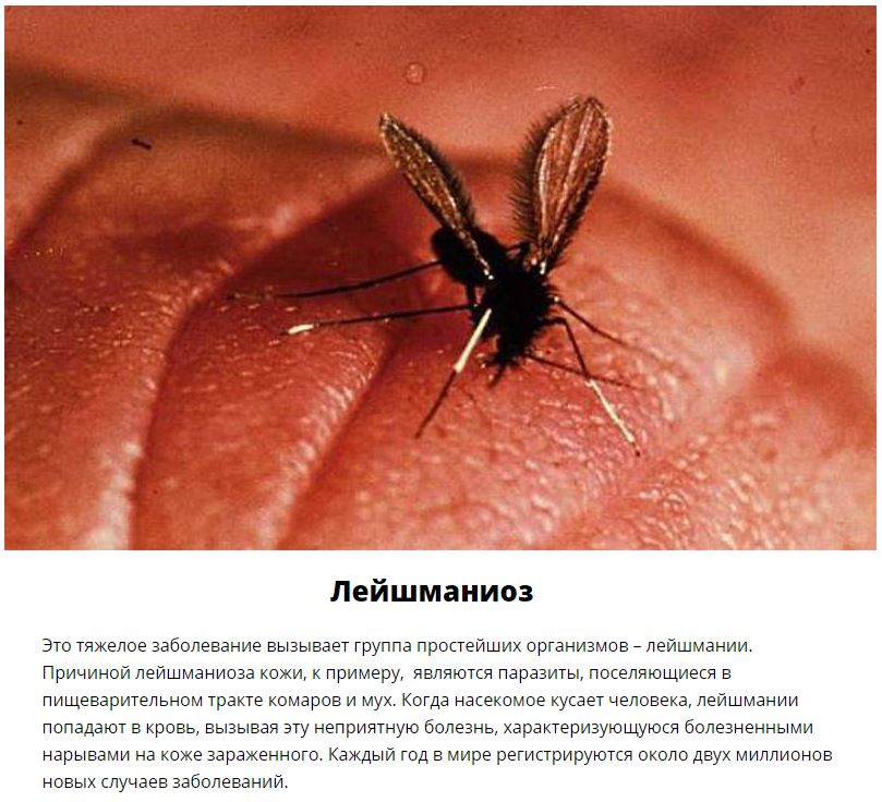 10 паразитов, которых следует опасаться летом