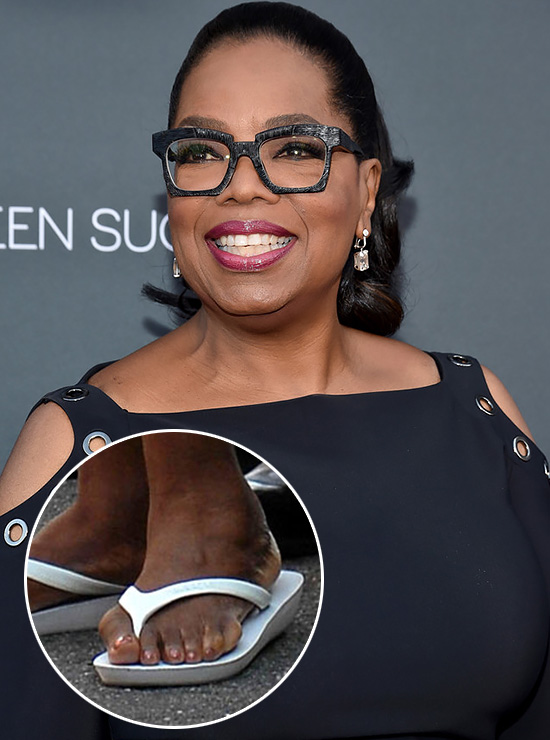 Изъяны или изюминка: звезды с дефектами внешности