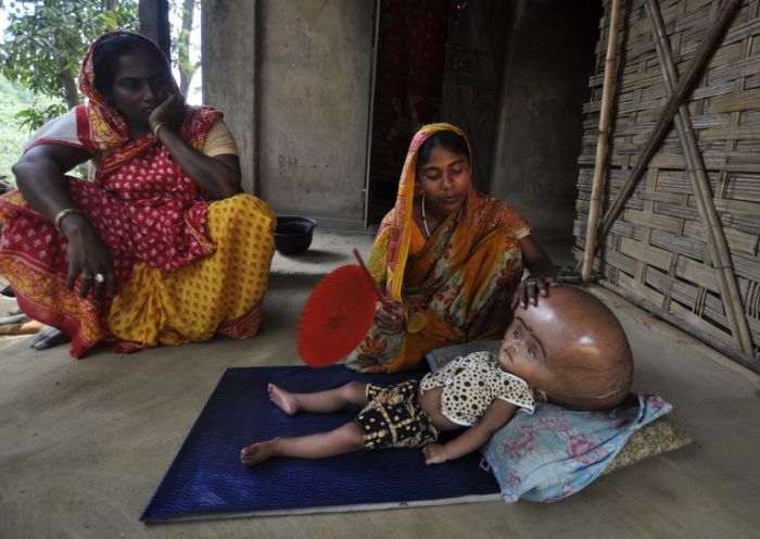 Девочка с гигантской головой (8 фото)