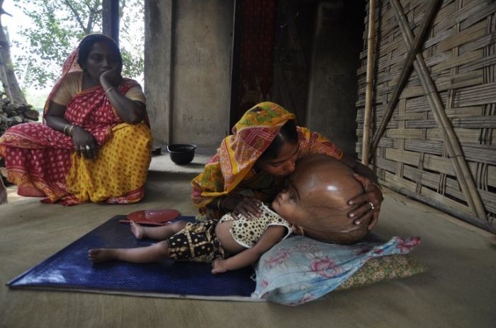 Девочка с гигантской головой (8 фото)