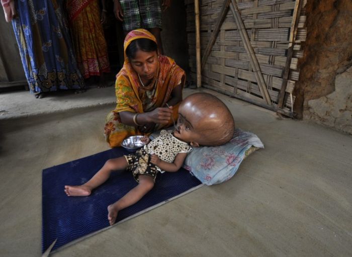 Девочка с гигантской головой (8 фото)