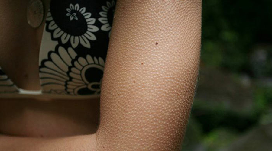 Защитные реакции нашего организма