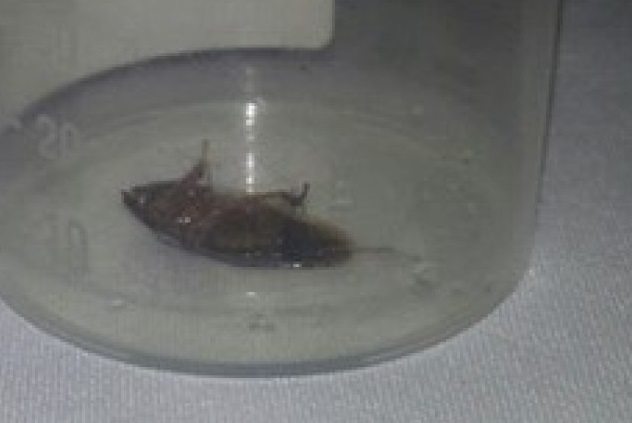 «Ушные квартиранты», или кого вытаскивали на белый свет врачи-отоларингологи?