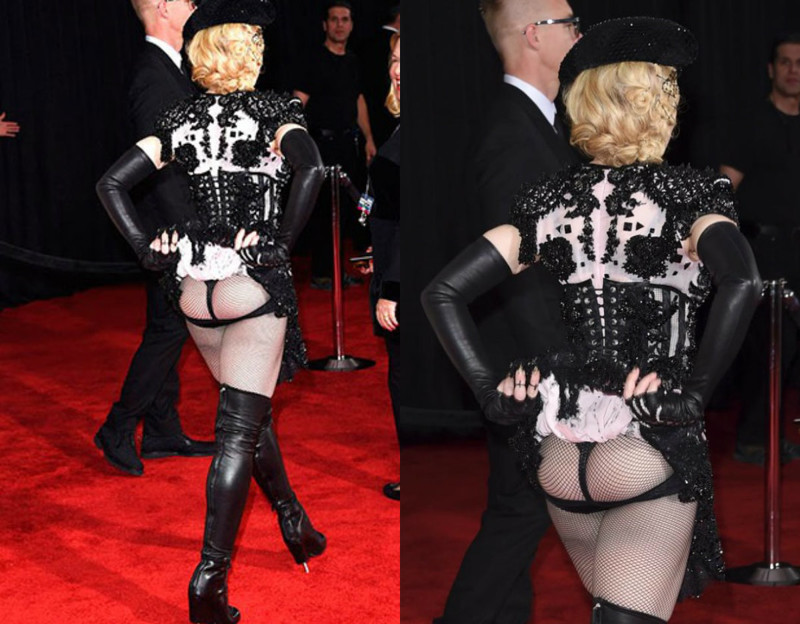 Заработались: звезды, появившиеся на публике без юбки