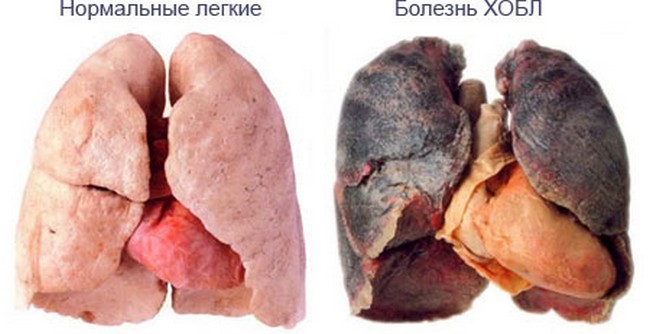 Факты о курении и сигаретах