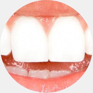 Ошибки эволюции в развитии человека (11 фото) Ошибки эволюции в развитии человека (11 фото)