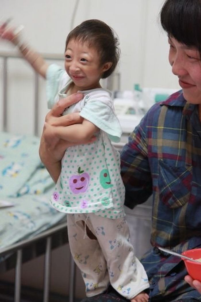 Самая маленькая девочка в мире (7 фото) Самая маленькая девочка в мире (7 фото)