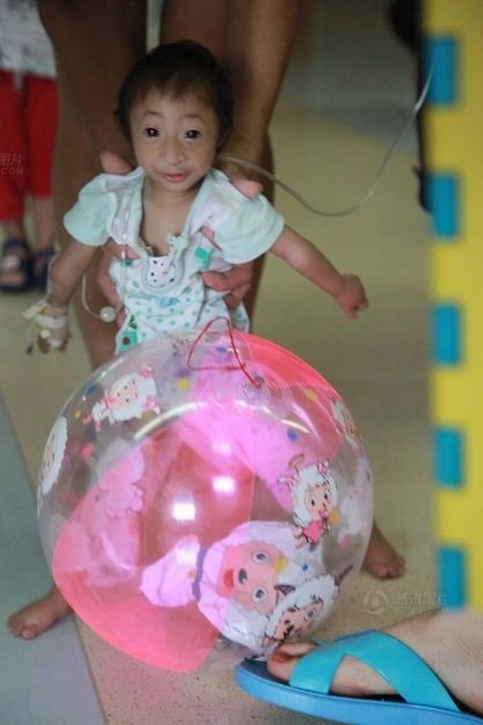 Самая маленькая девочка в мире (7 фото) Самая маленькая девочка в мире (7 фото)