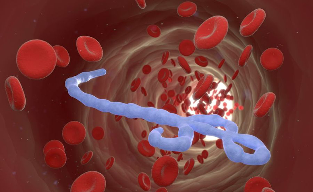 Эпидемии, непонятно откуда взявшиеся Эпидемии, непонятно откуда взявшиеся