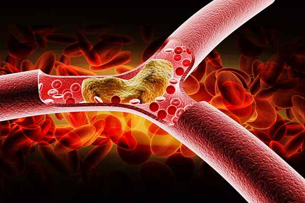 25 фактов, которые нужно знать о холестерине