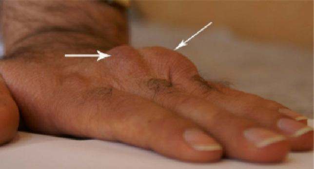 25 фактов, которые нужно знать о холестерине