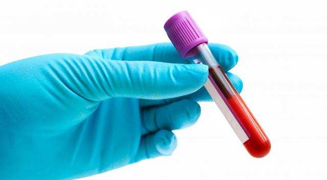 25 фактов, которые нужно знать о холестерине