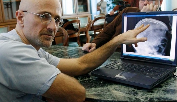 Итальянский нейрохирург пересадил голову Итальянский нейрохирург пересадил голову