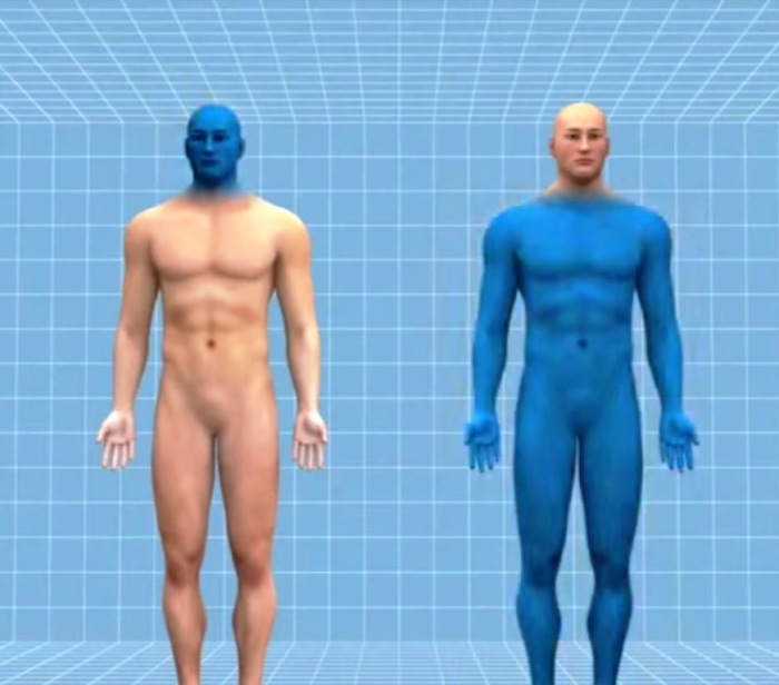 Итальянский нейрохирург пересадил голову Итальянский нейрохирург пересадил голову