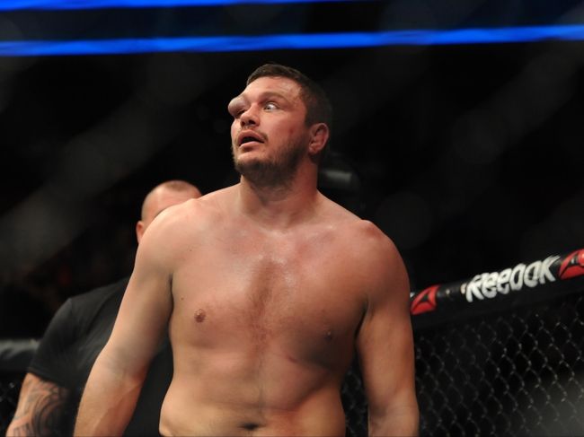 Самая отвратительная травма глаза в истории MMA