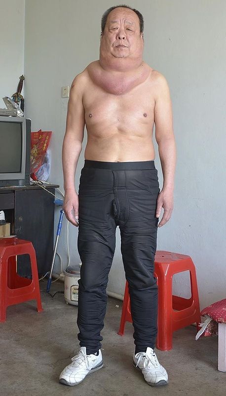 Самая толстая шея