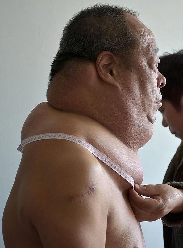 Самая толстая шея