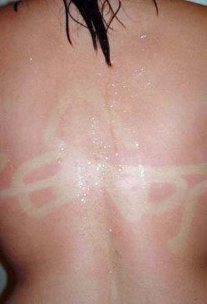 Как не надо загорать (26 фото)