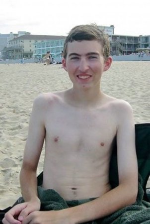 Как не надо загорать (26 фото)